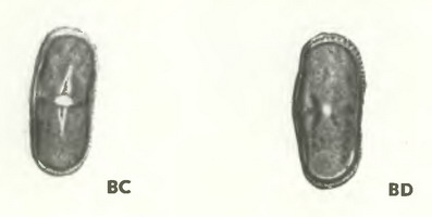 Сныть обыкновенная (Aegopidium podagraria L.) - пыльцевые зерна Сныть обыкновенная (Aegopidium podagraria L.) - пыльцевые зерна